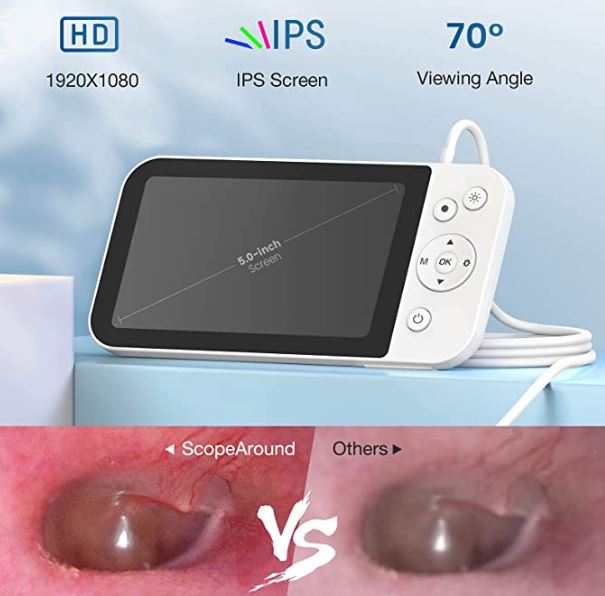 ScopeAround Ear Wax Removal Camera