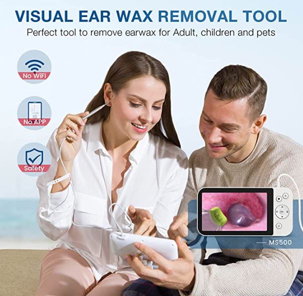 ScopeAround Ear Wax Removal Camera