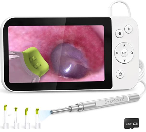 ScopeAround Ear Wax Removal Camera