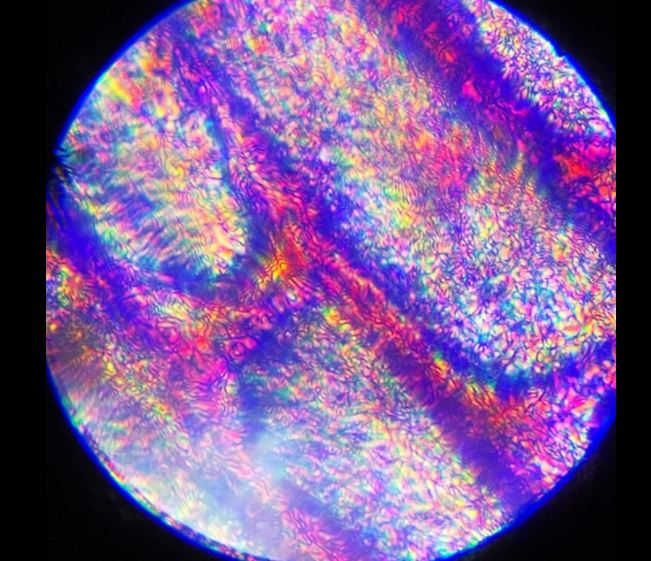 OSCTAN-Intelligent-Microscope image quality sample